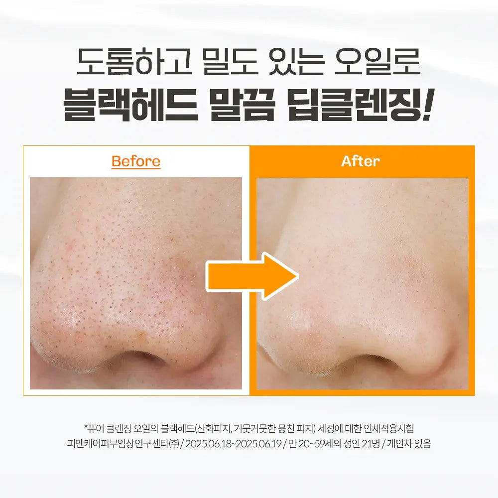 MA:NYO - Pure Cleansing Oil 純淨卸妝油 300ml (贈25ml x2)